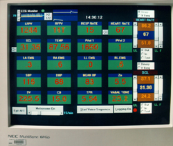 This image shows the feedback control screen on Big Al. The operator selects the parameters to be shown to the subject. Controls are also shown for auditory tones, a metronome and recorded voice instructions.