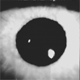 Figure 1. A. Subsampled video image of the anterior structures of the eye. The central dark disk is the pupil, formed by the edge of the iris. The two bright features within the pupil are the first and fourth Purkinje images, whose relative positions give a precise indication of gaze direction. 